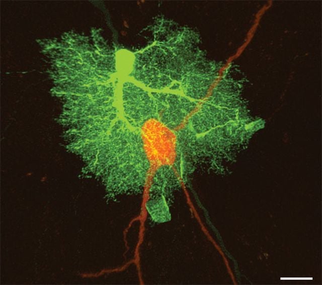 Mi szükség van az idegsejtek közti „ragasztóanyagra&#8221;?