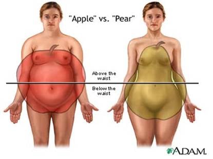Az alma típusú elhízás