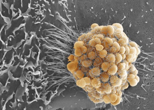 Emberről-emberre terjedő fertőző betegségek (antroponózisok)