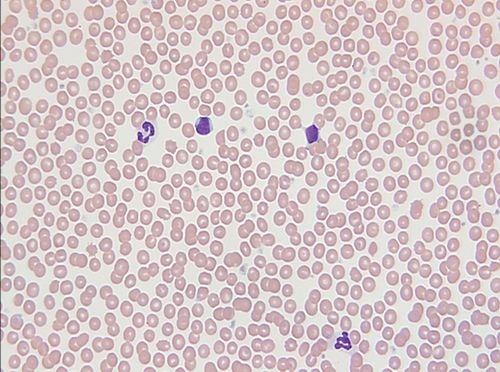 Haematológiai laboratóriumi vizsgálatokról