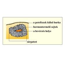 A sárgatest