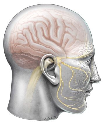 Trigeminus neuralgia