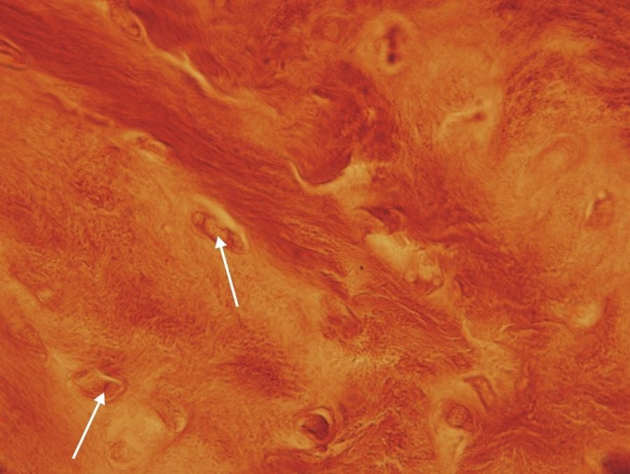 Állategészség védelem: A fehérje-anyagcsere zavara