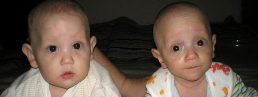 Retardált csecsemők