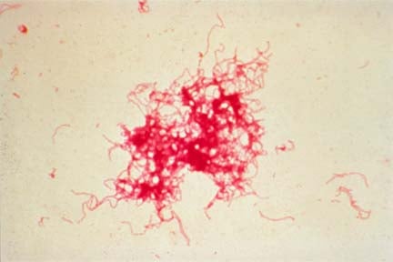 A fekélybetegek étrendje