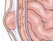 A sérvekről gyermekkorban