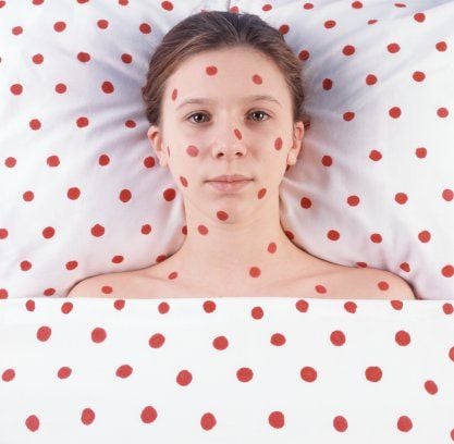 Fogékonyság – immunitás