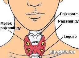 Mellékpajzsmirigy alulmüködés