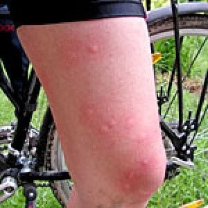 Rovarcsípés allergia