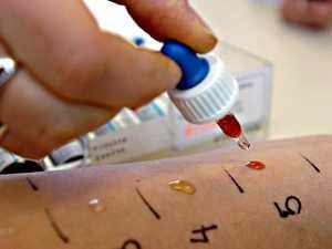 Visszatérő gyakori allergiafajta: Ételallergia