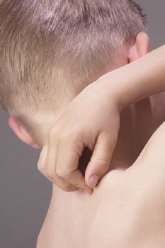 Segítség, mindenem viszket!